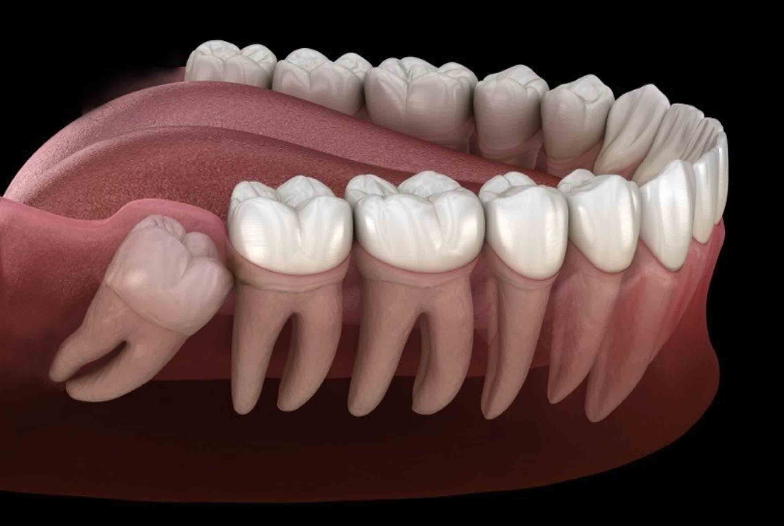 smilekraft minor surgical
